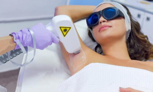 Lazer Epilasyon Cihazı