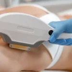 IPL Epilasyon Nedir?